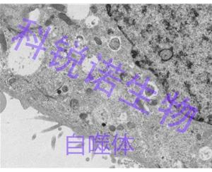 自噬體